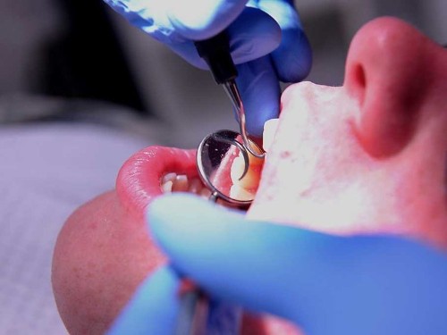 New Technology Could Take The Drill Out Of The Dentist’s Office