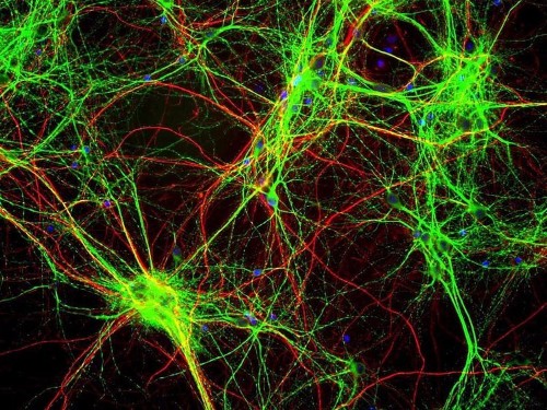This is the best scientific argument that your brain isn't a computer