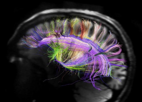 The first results of a brain study reveal something fascinating about smart, successful people