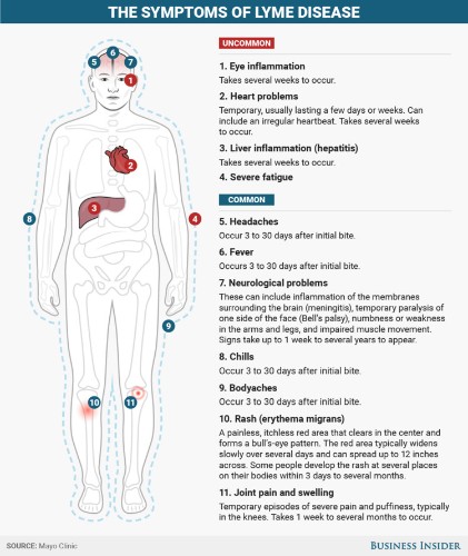 How to know if you have Lyme disease, which affects 300,000 Americans yearly