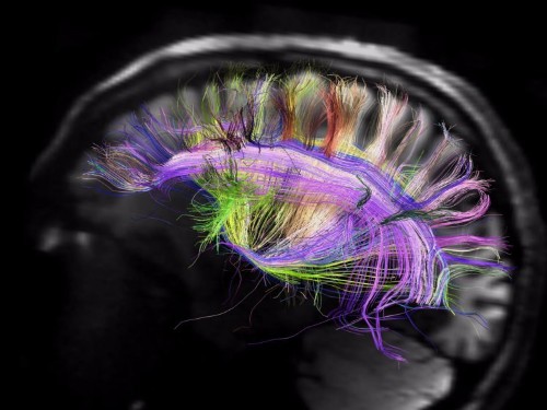 There might be an algorithm that explains intelligence