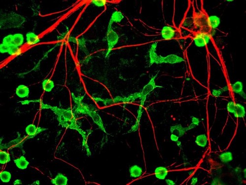 One scientist may have solved a mystery behind brain disorders like Alzheimer’s and schizophrenia