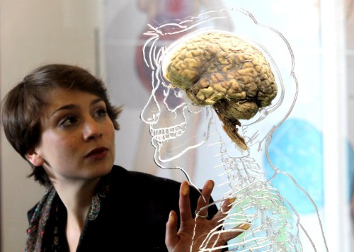 People with these rare brain disorders have a disturbingly skewed perception of reality