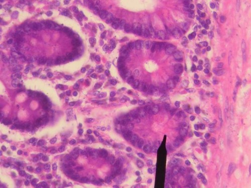 Biology Shows Us How To Prevent Hackers From Stealing Data