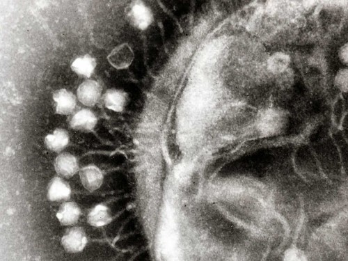 Viruses discovered a century ago may be our best defense against a threat that could kill 10 million people a year by 2050