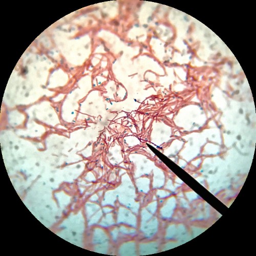 Over and over again, the military has conducted dangerous biowarfare experiments on Americans