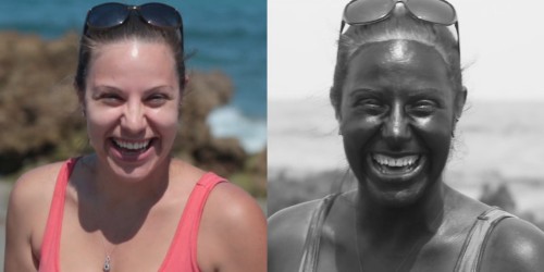 This tiny camera can tell you if you need to put on more sunscreen