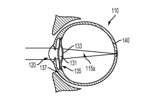 Google has a crazy idea for injecting a computer into your eyeball