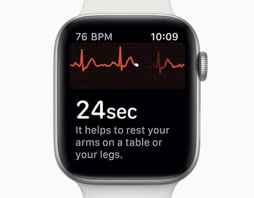 Apple Watch wearers in U.K. could wait years for ECG feature