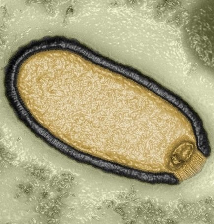 Could Giant Viruses Be the Origin of Life on Earth?