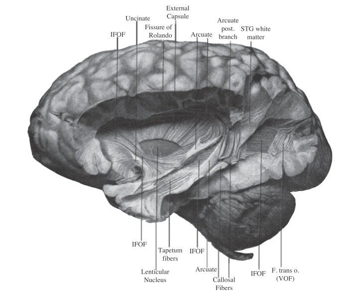 Scientists Rediscover A Part Of The Brain That Was Forgotten For 100 Years