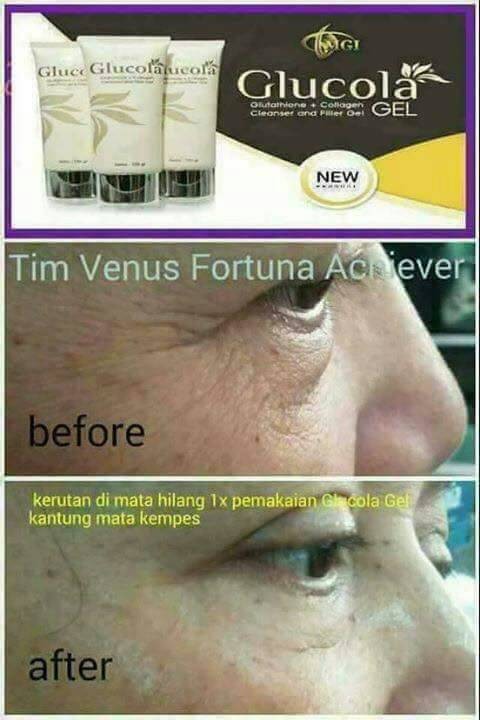 #MengingatkanKembali :) #GlucolaGel bukan pelembab, bukan foundation, bukan pula day cream ya. Jadi ngga masalah kalo meski uda pake Glucola Gel kamu tetep pakai krem atau make up apa aja. Karena fungsi Glucola Fel adalah sebagai: 1.CLEANSER(pembersih,pengangkat komedo, bekas jerawat dan memudarkan flek, kerutan) 2. FILLER (menutrisi kulit) dengan kandungan collagen dan gluthathione 500 dalton. Hasil dari pemakaian Glucola Gel bisa dilihat dari foto di bawah ini... :D Order sekarang juga!! Jangan tunggu wajahmu terlihat makin tua ;) Kan malu wajah ngga sesuai umur 😂😂😂 More info Fifi (WA 082126911503)