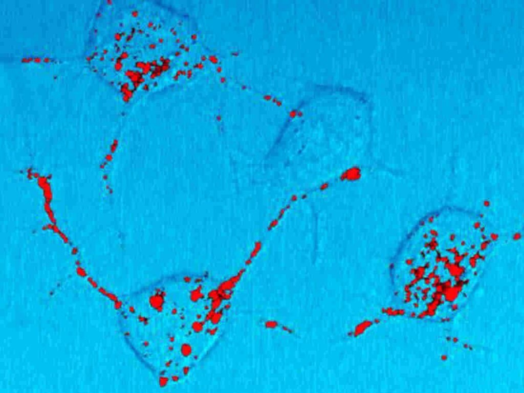 Mad Cow Research Hints At Ways To Halt Alzheimer's, Parkinson's