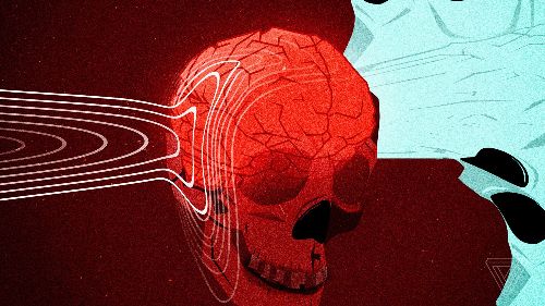 What I learned about concussions — by having one