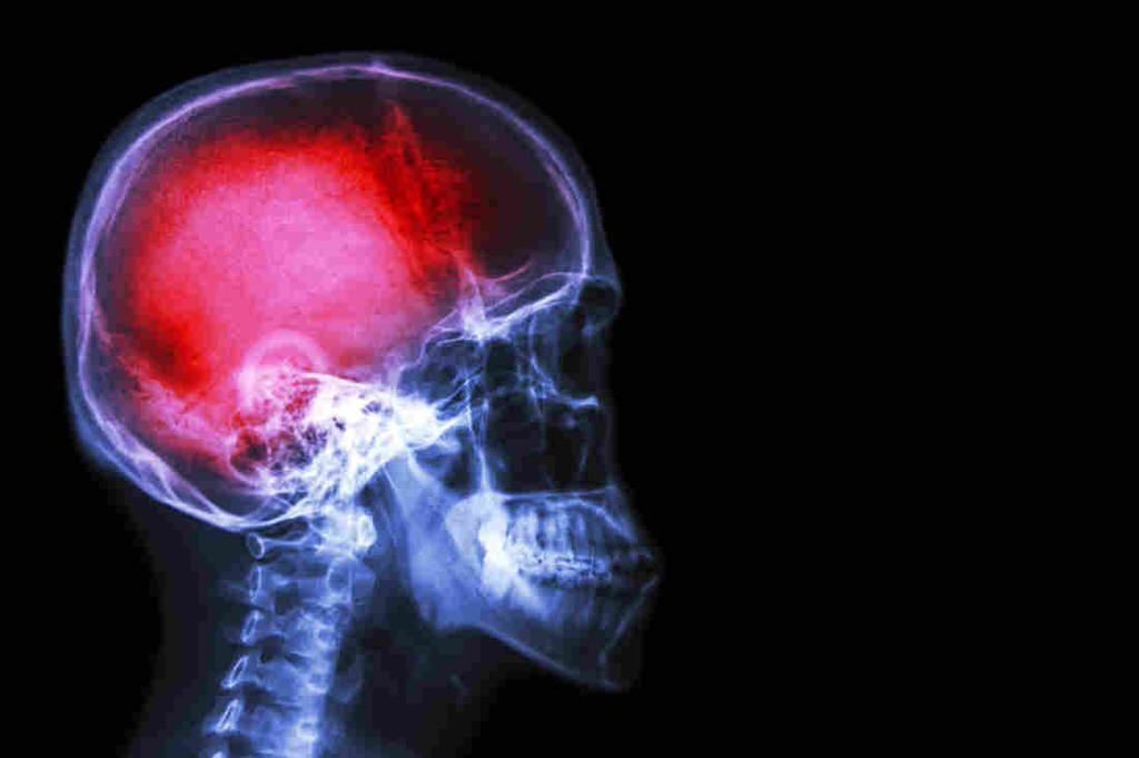 Pain Really Is All In Your Head. Emotion Controls Intensity