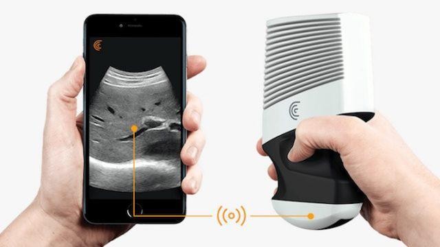 This Mobile Ultrasound Startup Is Reshaping A $6 Billion Healthcare Market