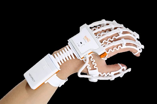 This Smart Glove Speeds Rehabilitation Of Stroke Patients