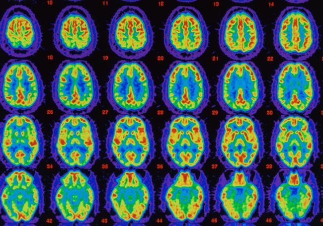 7 Habits That May Actually Change The Brain, According To Science