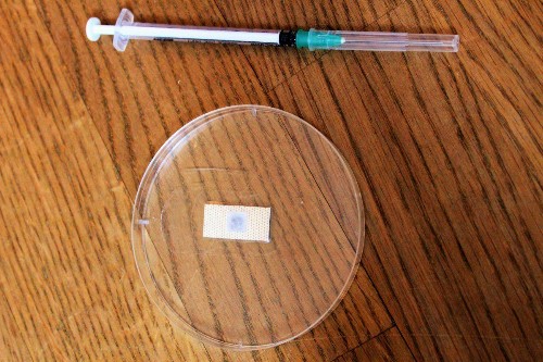A Painless Microneedle Patch For Diagnosing Tuberculosis