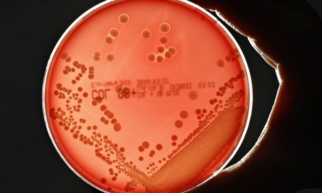 Call for new generation of antibiotics to fight off superbugs