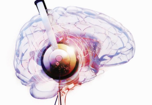 What Your Favorite Songs Can Tell You About The Way Your Brain Works
