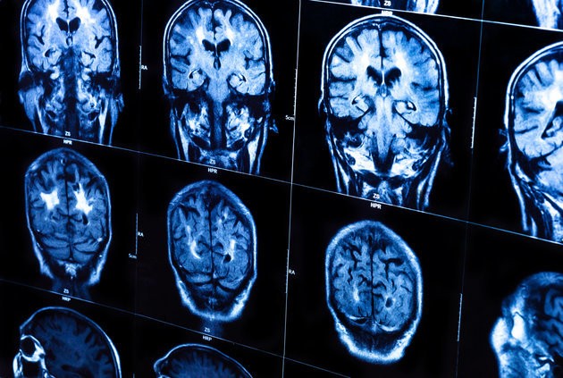 How Clever Are You Really? Scientists Can Now Accurately Measure Human Intelligence