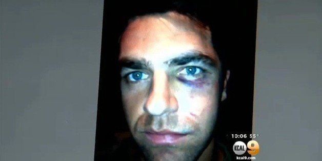 Deaf Man Allegedly Beaten, Tasered By Police After Trying To Use Sign Language