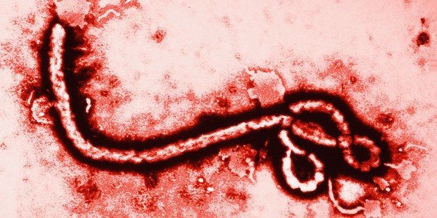 World Health Organization Approves Breakthrough 15-Minute Ebola Test