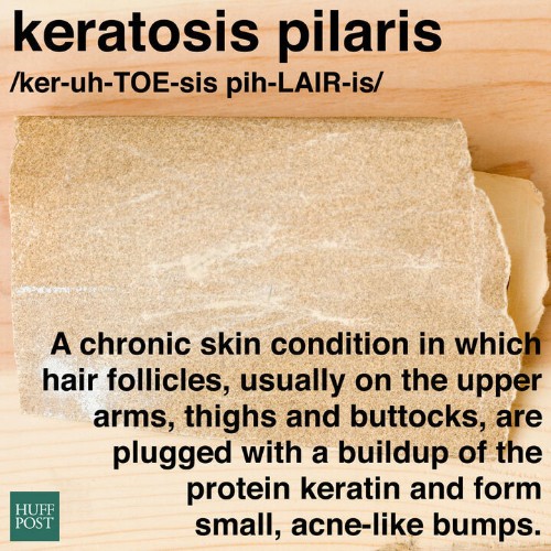 What Is Keratosis Pilaris, And Why Does It Look Like Body Acne? | HuffPost Life