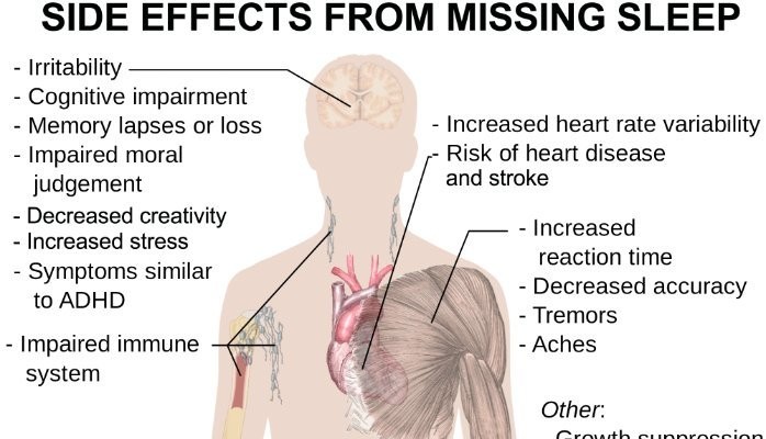 Sleep Deprivation Is Killing You And Your Career