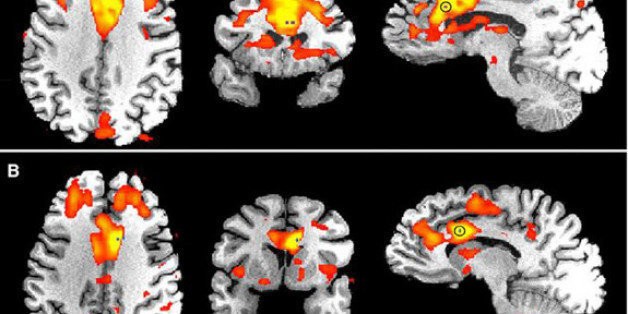 This Is Where Perseverance Lives In The Brain