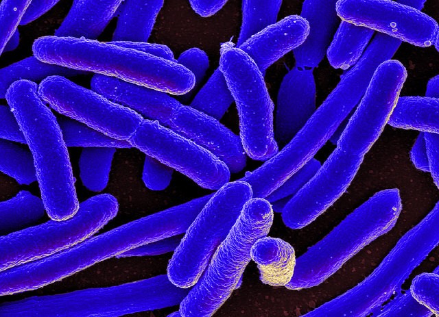 Leaky Gut Syndrome: What You Should Know About Your Gut Bacteria