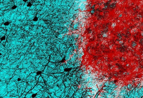 Scientists Take Big Step Toward Being Able To Repair Brain Injuries