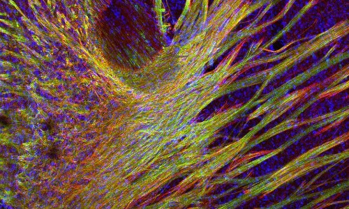 These Stunning Images Show The Brain's Fragile Beauty & What Happens When The Wiring Goes Awry