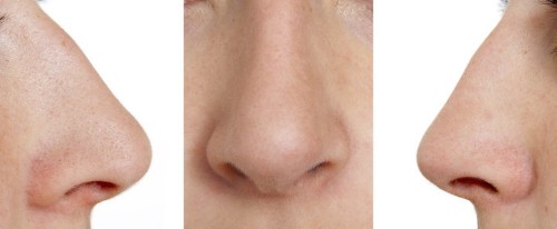 How Your Ancestors' Environment Determines The Shape Of Your Nose | HuffPost Life