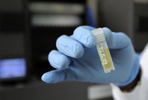 HIV cure dealt a setback - Los Angeles Times