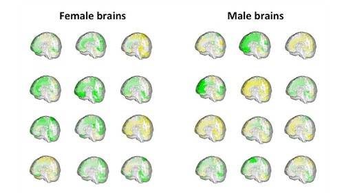 There's no such thing as a 'male brain' or 'female brain,' and scientists have the scans to prove it