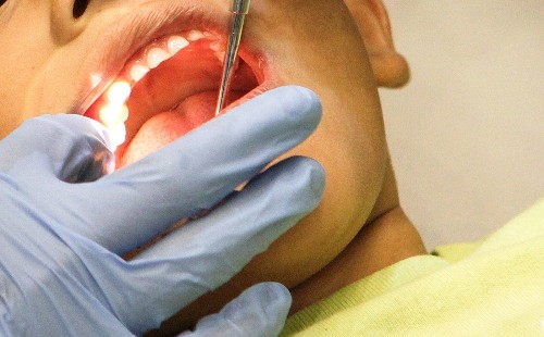 New technique could heal teeth painlessly, avoid cavities