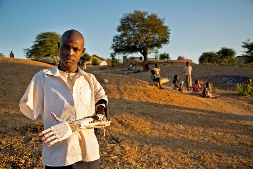 With ingenuity and a 3-D printer, group changes lives