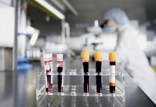Cancer screening: An example of when less can be more, experts say - Los Angeles Times