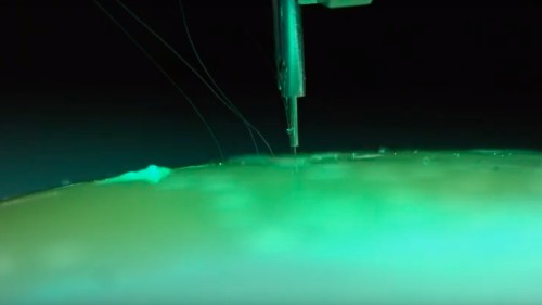 Elon Musk's robot surgeon will sew electrodes into human brains, starting in 2020