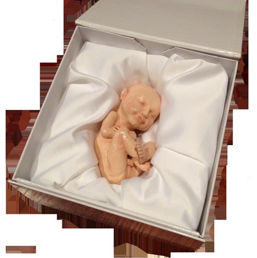 Custom 3D Fetus Sculptures Made from Ultrasound Images