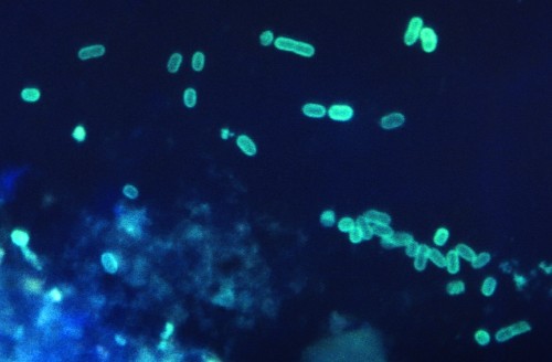 Food Poisoning: An Untrackable Illness In A Globalized World