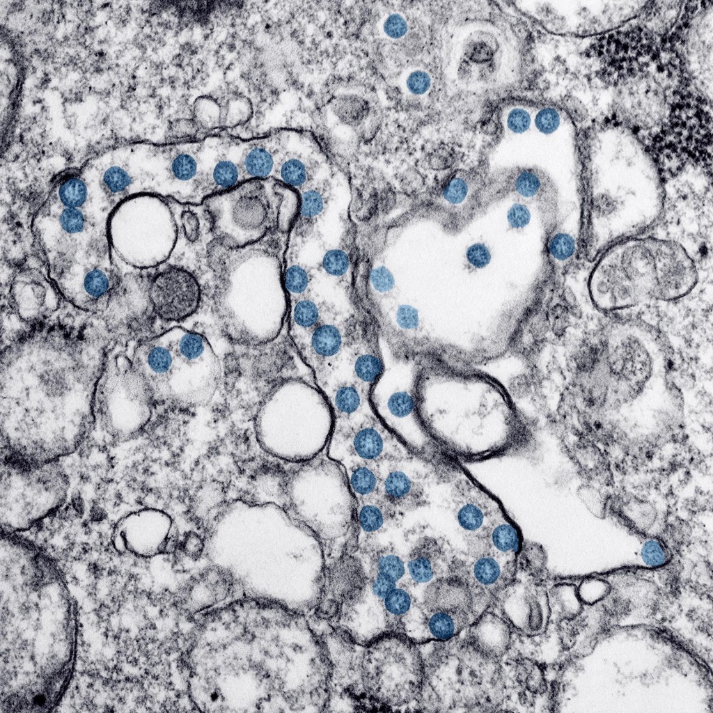 How coronavirus mutations can track its spread—and disprove conspiracies