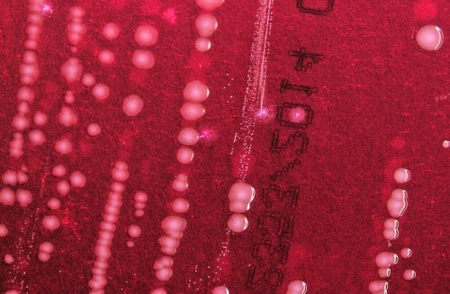 CDC Alert: Drug-Resistant Foodborne Illness Spreads in US