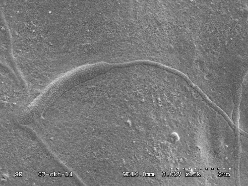 50-Million-Year-Old Worm Sperm Found in Antarctica