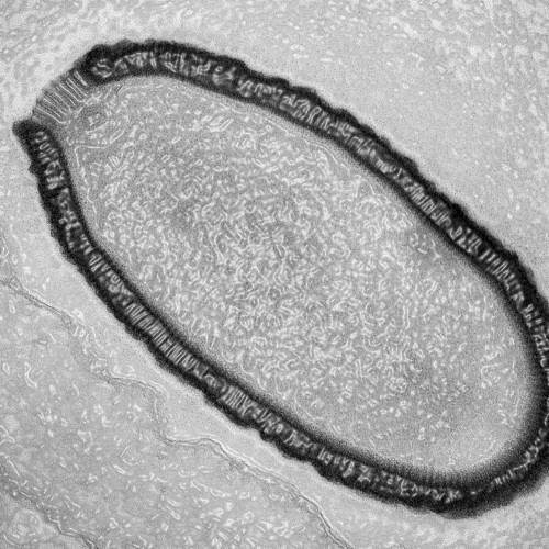 Ancient "Giant Virus" Revived From Siberian Permafrost
