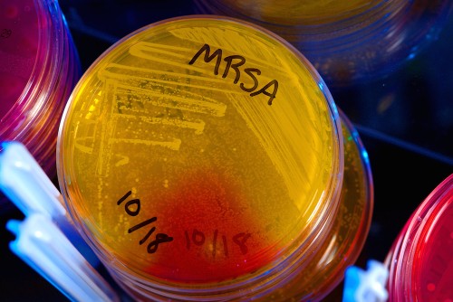 Pharma Industry Calls on Governments to Fund New Antibiotics