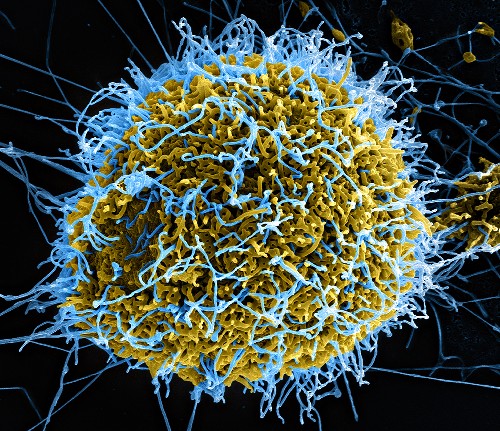 Tracking a Serial Killer: Could Ebola Mutate to Become More Deadly?