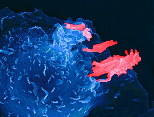 Tuberculosis' Game Of Hide And Tweak